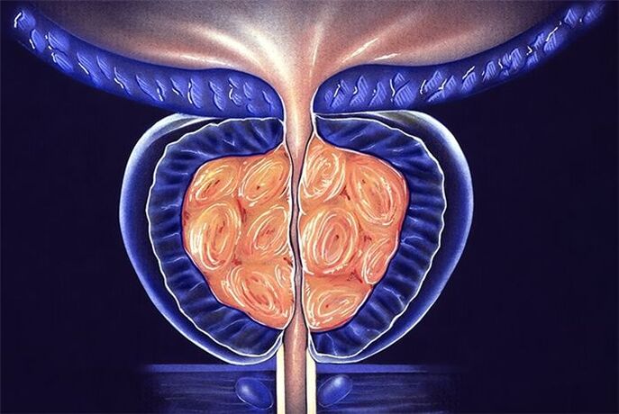 Symptoms and treatment of prostatitis